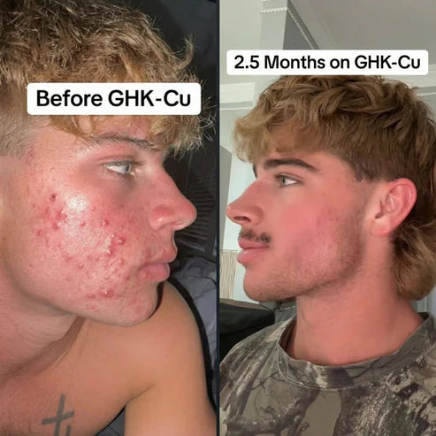ghk-cu nose spray GHK-Cu Nasal Spray 50mg