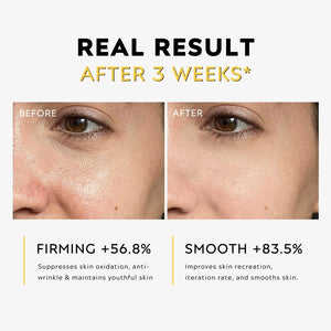 Silk Lifting Peptide | Face-Lift ar Home serum with peptide